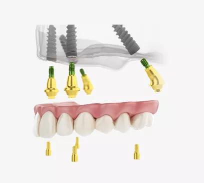 Alpha Arch by Alpha-Bio Tec.